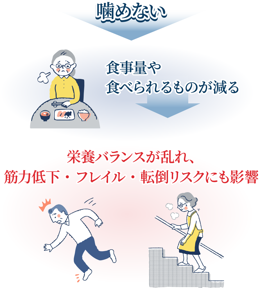 噛めないと食事量や食べられるものが減る、栄養バランスが乱れ、筋力低下・フレイル・転倒リスクにも影響