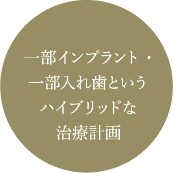 一部インプラント・一部入れ歯というハイブリッドな治療計画